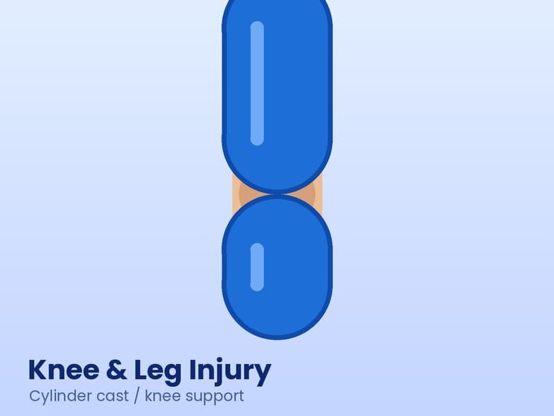 Illustration of a leg with a blue cylinder cast for knee and leg injury care